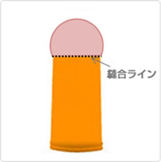 包茎手術の手順イメージ02