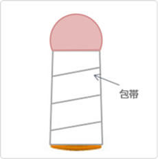 包茎手術の手順イメージ03