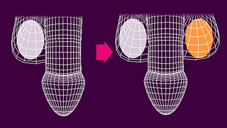 偽睾丸挿入術イメージ01